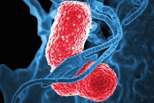 Image: Researchers have developed a method to quickly identify the most appropriate treatments for bacterial infections (Photo courtesy of Shutterstock)